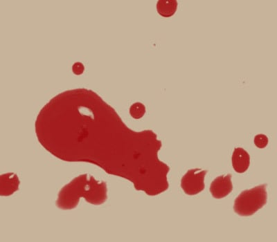 smears